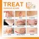CARBOU Silicone Scar Sheets (1" x 60"Roll, Soft Silicone Scar Tape for Scars Removal, Reusable Easy-Tear Silicone Tape Painless Scar Removal for Surgery, C-section, Burn, Acne, Keloid, Thyroid.