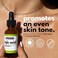 Skin Set Go Dark Spot Remover Serum For FaceDark Spot CorrectorDiscoloration DefenseSkincare Travel Bag IncludedKojic Acid SerumSun Spot RemoverHyperpigmentation Control (2 fl oz.60 ml.