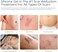 MURASAKI BEAUTY Silicone Scar Gel 30g Scar Cream,Scar Removal,Scar Treatment, Scar Removal Cream for C-Section, Stretch Marks, Acne, Surgery, Effective for Both Old and New Scars.
