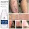 MURASAKI BEAUTY Silicone Scar Gel 30g Scar Cream,Scar Removal,Scar Treatment, Scar Removal Cream for C-Section, Stretch Marks, Acne, Surgery, Effective for Both Old and New Scars.
