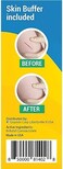 HelsRx Liquid Bandage, Liquid Skin Repair for ed Heels, Feet, Fingers, Scrapes and Blisters &ndash; Waterproof Liquid Treatment for All Skin Areas (0. 17 Fl Oz.