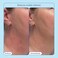Skinfix Skin Fix Barrier Triple Lipid-Peptide Cream 1. 7 oz.