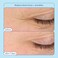 Skinfix Barrier Lipid-Boost 360 Eye Treatment 0. 5 oz.