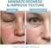Eva Naturals Azelaic Acid 10% Facial Serum, 2 oz. , Skin Brightening Hyaluronic Acid and Niacinamide, Redness Relief, Fade and Repair Dark Spots.