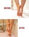 Kerasal Nightime Intensive Foot Repair Ointment for ed HeelsDry Feet with ZenToes Moisturizing Heel Socks, Combo Pack.