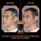 L&rsquo;Or&eacute;al Paris Men Expert One Twist Mess Free Permanent Hair Color, Mens Hair Dye to Cover Grays, Easy No Mix Ammonia Free Application, Medium Brown 04, 1 Application.