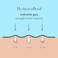Rael Pimple Patches, Miracle XL Spot Control Cover - Hydrocolloid Acne Patches for Face, Zit and Blemish Spot, Back and Body, for All Skin Types, Vegan, Cruelty Free (6 Count.
