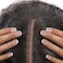 STUDIO LIMITED Lace Wig Grids and Knots Eraser Silicone Melting Tape, Bye Bye Lace Grid HD Natural Hide Cover Skinlike Durable Breathable Reusable Ultra-Thin Non-Slip Tape (NATURAL.