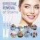 VieBeauti Teeth Whitening Pen (3 Pcs, 30Uses, Effective, Painless, No Sensitivity, Travel-Friendly, Easy to Use, Beautiful White Smile, Mint Flavor