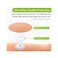 KOVOQ 40-Pack Libre 2Lingo Sensor Covers, Kovoq Freestyle Libre 2 Sensor Waterproof Patches, 2 Hard Covers for Reliable Protection Against Bumps and Scratches, Breathable and Hypoallergenic (TAN