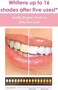 Novashine Teeth Whitening Kit Advanced Blue LED Light Gloss White
