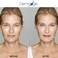 Dermlogic Anti Aging Resurfacing Peel Pads - Contains Salicylic, Glycolic, Lactic Acid for FaceBody Including Hyaluronic Acid, Witch Hazel, Green TeaAloe Vera. Exfoliates to Correct Dark SpotsScars.