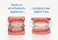 ORVANCE OrthoDots Moisture Activated, Silicone Dental Wax Alternative for Braces (24 Count Clear