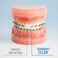 ORVANCE OrthoDots Moisture Activated, Silicone Dental Wax Alternative for Braces (24 Count Clear