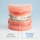 ORVANCE OrthoDots CLEAR (48 Count- Moisture Activated, Silicone Dental Wax Alternative for Pain Caused by Braces. OrthoDots Stick BetterStay on Longer than Orthodontic Wax (48 Count Clear