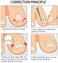 Gnker Ingrown Toenail Pedicure Tool 10pcs/bottle Straightening Clip Curved BS Brace Toenails Thick Paronychia Correction Tool Foot