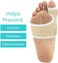 VIVE Bunion Brace Big Toe Corrector Straightener With Splint Hallux Valgus Pad Joint Pain Relief Alignment Treatment Orthopedic Sleeve Foot Wrap Support One Size Beige