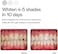 Opalescence go 15% teeth whitening trays (4 pack, mint flavor
