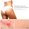 Oxyderm. ButtThigh Acne Treatment Peel Pads- Exfoliating Treatment Pads to Eliminate Acne Causing Bacteria. Removes Pimples, BlemishesIngrown Hairs for the ButtocksThigh Area for Both MenWomen.