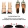 Dr Foot Dr. &rsquo;s Orthopedic MedialLateral Heel Wedge Gel Insoles for SupinationPronation, Adhesive Inserts for Alignment, Knee Pain, Bow Legs, Osteoarthritis - 3 Pairs (TransparentBrownBlack