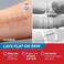 Clozex Emergency Laceration Kit - Repair Wounds Without Stitches. FDA Cleared FSA HSA Eligible Skin Closure Device for a Wound Up to 1 1/2 Inches Length. Complete Kit to Clean, Close,Cover Wounds