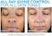 La Roche-Posay Toleriane Double Repair Matte Face Moisturizer, Daily Gel Moisturizer For Oily Skin Control with Niacinamide, Oil-Free, Non-Comedogenic, Moisturizing for Sensitive Skin