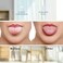 Bealihelp 2 Pack Tongue Scraper, 100% Surgical 304 Stainless Steel Tongue Cleaner for Adults And Kids, Professional Tongue Brush for Oral Care, Improve Bad Breath and Fresh Breath