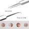 BLAAROOM Professional Blackhead Remover Pimple Popper Tool,Comedones Extractor Acne Removal Tweezers for Blemishs，Whitehead Popping,Zit Removing for Nose Face,Stainless Steel Makeup Tool
