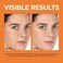 L&rsquo;Or&eacute;al Paris L'Oreal Paris Revitalift 12% Pure Vitamin C Serum, Vitamin E, Salicylic Acid, Brightening 1 ozMoisturizer Sample