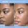Then I Met You Renewing Rich Beauty Cream, Hydrating Face Moisturizer with GinsengSqualane, VeganClean Skincare, 1.69 oz