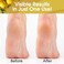 DeEnterprises, Inc. Callus Remover Gel, Extra Strength Foot Callus Remover, 8oz Salon Grade Home Pedicure Supplies for Rough, Dry, Cracked Skin, Heavy Duty Callus Remover for Feet, Lemon