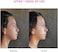 FOREO FirmFabulous BEAR mini PinkSerum Serum Serum 30mlMicrocurrent Face Lift DeviceFace MassagerFacial Skin Care ProductsGiftsSkincare Tools Gift BoxGift Sets