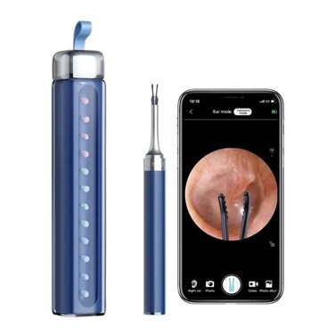 4 in 1 Ear Tweezers with Camera   Ear Camera Otoscope with Light BLUE