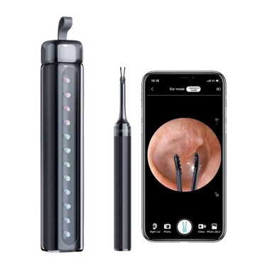 4 in 1 Ear Tweezers with Camera   Ear Camera Otoscope with Light