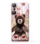 Generic TPU Protective Back Case Cover For Infinix Hot 20 (4G) With My Teddy Bear