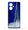 غطاء حماية خلفي للهاتف المحمول مصنوع من مادة TPU، متوافق مع هاتف OnePlus Nord N30 SE بتصميم رقم 11.