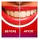 Colgate Max White Ultimate Renewal Toothpaste