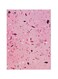 Decorative Printed Metallic Plate Pink/Purple 20x15cm