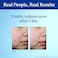 Differin Acne Spot Treatment With 10% Benzoyl Peroxide, Maximum Strength OTC Acne Treatment, Fast Acting Spot Treatment For Face, 1 Oz
