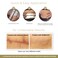 Embrace Active Scar Defense for New Scars FDACleared Silicone Scar Sheets 63 Inch XLarge 30 Day Supply  Packaging May Vary
