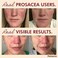 ProsaceaHeals Rosacea Symptoms of Redness Pimples and Irritation  Twin Pack  Two 075oz Tubes 15oz Total