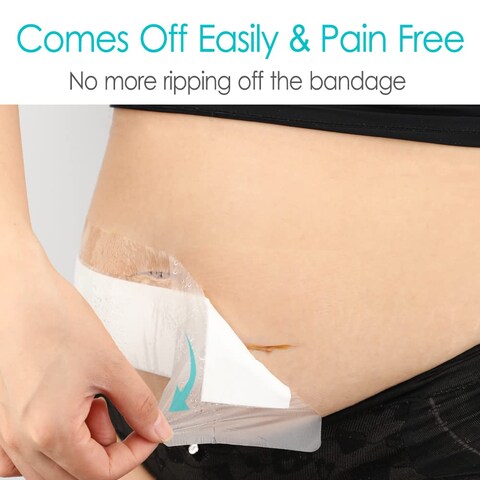 Large Waterproof Bandages for Knee Replacement Surgery Hip Surgery Wound Shower Cover Long Incision Post Back Surgical Island Dressing Bordered Gauze with NonStick Pad 4x10 25 Pack