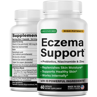 Eczema Treatment  Support for Natural Relief  Made in USA Dupixent Alternative  Skin Vitamins  Herbals for Eczema Acne Psoriasis Rosacea Treatment with Zinc Niacinamide  Probiotics  60 caps