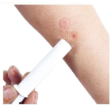 2PK Mosquito Bee Sting Bug Bite Kit Suction Tool Safety First Aid Supplies Tool Natural Sting First Aid for Hiking Backpacking Camping