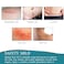 Silicone Scar Sheets  16x 60 Professional Scar Removal Sheets for CSection Burn Acne  Soft Silicone Gel Scar Tape