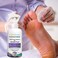 SkinSmart Daily Foot Cleanser for AtRisk Feet Removes Bacteria to Help Avoid Infections 8 ounce Spray