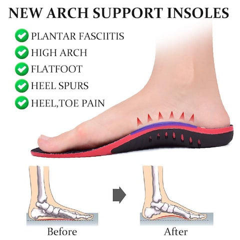 Insoles for arch pain on sale