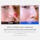 MedicubeZero Pore Pads 20 DualTextured Facial Toner Pads for Exfoliation and Pore Care with 45 AHA Lactic Acid  045 BHA Salicylic Acid Ideal for All Skin Types Korean Skin Care 70 Pads