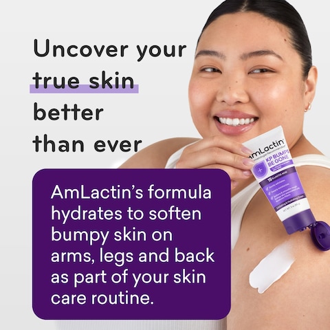 AmLactin KP Bumps Be Gone  3 oz Keratosis Pilaris Moisturizing Cream with 15 Lactic Acid  Exfoliator and Moisturizer for Dry Rough and Bumpy Skin Packaging May Vary