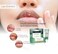 MorazPolygonum Dry Lip Ointment  Lip Moisturizer for Dry Cracked Lips  Herbal Concentrated Lip Balm  Lip Mask for Intensive Hydration  034 oz